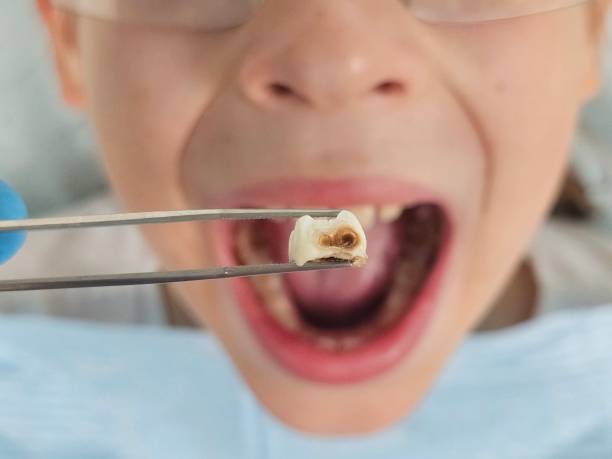 Best Emergency Dentist for Kids  in San Benito, TX